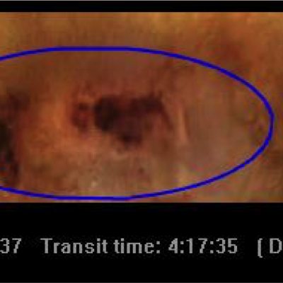 Morbus Crohn Abb_2